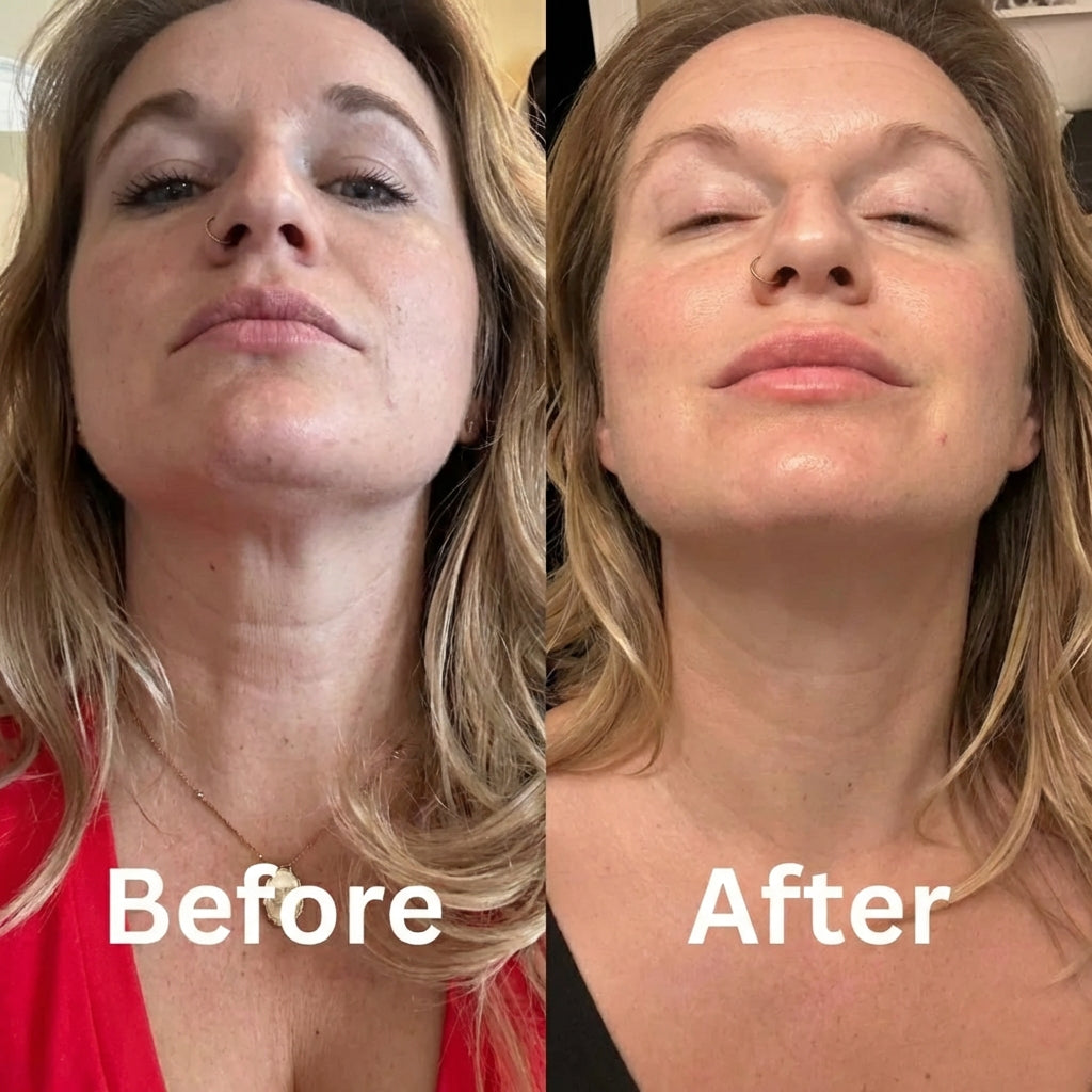 Névia™ Collagen Neck Mask